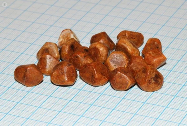 Red Ox Gallstone