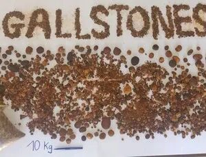 Gallstones Available cow ox Ash % 8